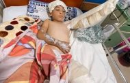 صعق كهربائي يتسبب في بتر ذراع طفل بقرية تابعة لشركة القناة للتوزيع
